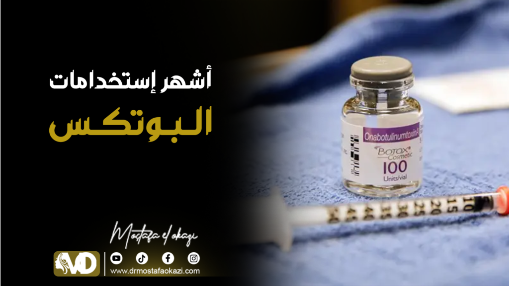 حقن البوتكس في الرياض 2025